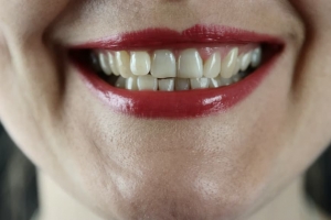 Which Foods Are Harmful To Teeth? Which Foods Are Harmful To Teeth?